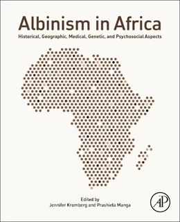 Abbildung von Kromberg / Manga | Albinism in Africa | 1. Auflage | 2018 | beck-shop.de