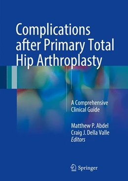 Abbildung von Abdel / Della Valle | Complications after Primary Total Hip Arthroplasty | 1. Auflage | 2017 | beck-shop.de
