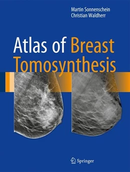 Abbildung von Sonnenschein / Waldherr | Atlas of Breast Tomosynthesis | 1. Auflage | 2017 | beck-shop.de