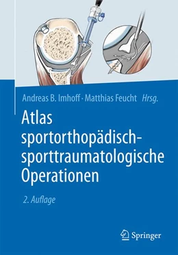 Abbildung von Imhoff / Feucht (Hrsg.) | Atlas sportorthopädisch-sporttraumatologische Operationen | 2. Auflage | 2017 | beck-shop.de