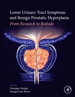 Abbildung von Morgia / Russo | Lower Urinary Tract Symptoms and Benign Prostatic Hyperplasia | 1. Auflage | 2018 | beck-shop.de