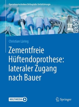 Abbildung von Lüring | Zementfreie Hüftendoprothese: lateraler Zugang nach Bauer | 1. Auflage | 2017 | beck-shop.de