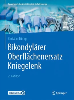 Abbildung von Lüring | Bikondylärer Oberflächenersatz Kniegelenk | 2. Auflage | 2017 | beck-shop.de