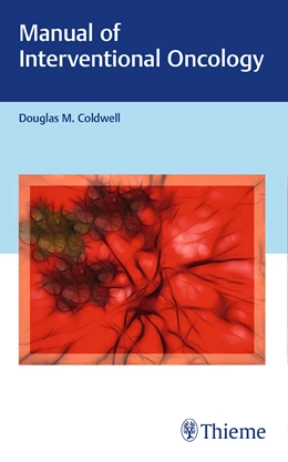 Abbildung von Coldwell | Manual of Interventional Oncology | 1. Auflage | 2017 | beck-shop.de