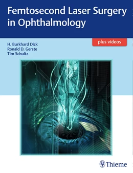 Abbildung von Dick / Gerste | Femtosecond Laser Surgery in Ophthalmology | 1. Auflage | 2018 | beck-shop.de
