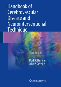 Abbildung von Harrigan / Deveikis | Handbook of Cerebrovascular Disease and Neurointerventional Technique | 3. Auflage | 2018 | beck-shop.de
