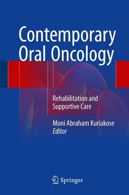 Abbildung von Kuriakose | Contemporary Oral Oncology | 1. Auflage | 2017 | beck-shop.de