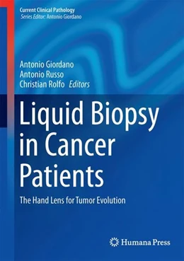 Abbildung von Russo / Giordano | Liquid Biopsy in Cancer Patients | 1. Auflage | 2017 | beck-shop.de