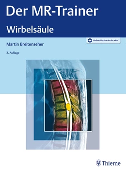 Abbildung von Breitenseher | Der MR-Trainer • Wirbelsäule | 2. Auflage | 2022 | beck-shop.de