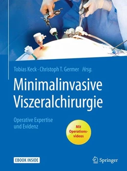 Abbildung von Keck / Germer | Minimalinvasive Viszeralchirurgie | 1. Auflage | 2017 | beck-shop.de