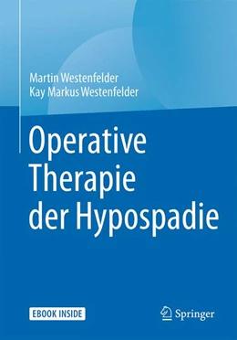 Abbildung von Westenfelder | Operative Therapie der Hypospadie | 1. Auflage | 2017 | beck-shop.de