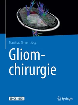 Abbildung von Simon | Gliomchirurgie | 1. Auflage | 2017 | beck-shop.de