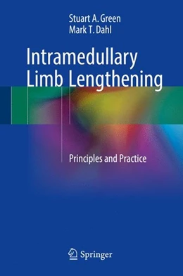 Abbildung von Green / Dahl | Intramedullary Limb Lengthening | 1. Auflage | 2017 | beck-shop.de