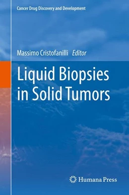 Abbildung von Cristofanilli | Liquid Biopsies in Solid Tumors | 1. Auflage | 2017 | beck-shop.de
