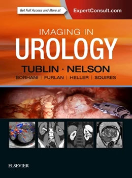Abbildung von Tublin / Nelson | Imaging in Urology | 1. Auflage | 2018 | beck-shop.de