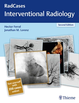 Abbildung von Ferral / Lorenz | RadCases Q&A Interventional Radiology | 2. Auflage | 2018 | beck-shop.de