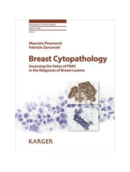 Abbildung von Pinamonti / Zanconati | Breast Cytopathology | 1. Auflage | 2018 | beck-shop.de