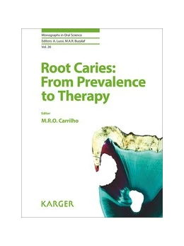 Abbildung von Rocha de Olivera Carrilho | Root Caries: From Prevalence to Therapy | 1. Auflage | 2017 | beck-shop.de