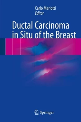 Abbildung von Mariotti | Ductal Carcinoma in Situ of the Breast | 1. Auflage | 2017 | beck-shop.de