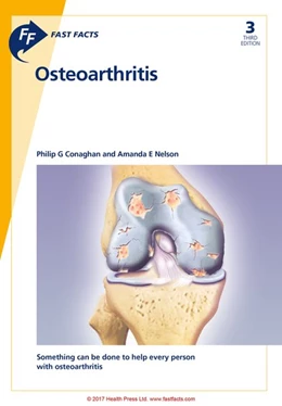Abbildung von Conaghan / Nelson | Fast Facts: Osteoarthritis | 3. Auflage | 2017 | beck-shop.de