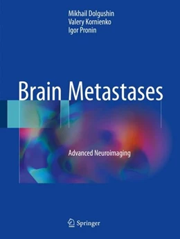 Abbildung von Dolgushin / Kornienko | Brain Metastases | 1. Auflage | 2017 | beck-shop.de