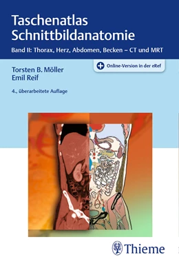 Abbildung von Möller / Reif | Taschenatlas Schnittbildanatomie • Band II: Thorax, Herz, Abdomen, Becken | 4. Auflage | 2019 | beck-shop.de