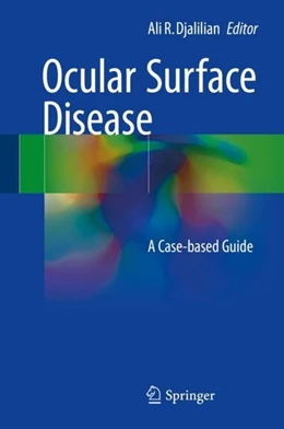 Abbildung von Djalilian | Ocular Surface Disease | 1. Auflage | 2017 | beck-shop.de