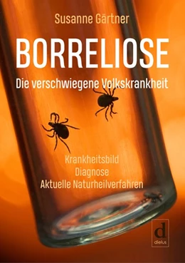 Abbildung von Gärtner | Borreliose - Die verschwiegene Volkskrankheit | 1. Auflage | 2018 | beck-shop.de