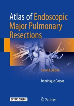Abbildung von Gossot | Atlas of Endoscopic Major Pulmonary Resections | 2. Auflage | 2017 | beck-shop.de