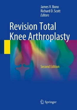 Abbildung von Bono / Scott | Revision Total Knee Arthroplasty | 2. Auflage | 2017 | beck-shop.de