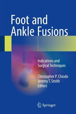 Abbildung von Chiodo / Smith | Foot and Ankle Fusions | 1. Auflage | 2017 | beck-shop.de