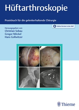 Abbildung von Sobau / Möckel | Hüftarthroskopie | 1. Auflage | 2018 | beck-shop.de