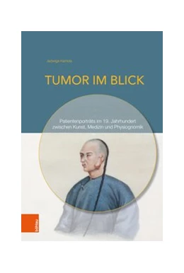 Abbildung von Kamola | Tumor im Blick | 1. Auflage | 2018 | beck-shop.de