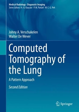 Abbildung von Verschakelen / De Wever | Computed Tomography of the Lung | 2. Auflage | 2017 | beck-shop.de