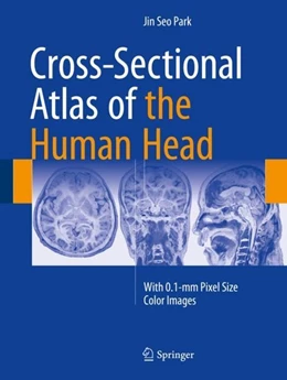 Abbildung von Park | Cross-Sectional Atlas of the Human Head | 1. Auflage | 2018 | beck-shop.de