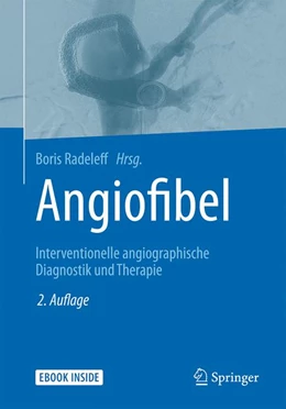 Abbildung von Radeleff (Hrsg.) | Angiofibel | 2. Auflage | 2021 | beck-shop.de