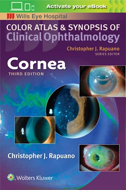Abbildung von Rapuano | Cornea (Color Atlas and Synopsis of Clinical Ophthalmology) | 3. Auflage | 2018 | beck-shop.de