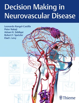 Abbildung von Rangel-Castilla / Nakaji | Decision Making in Neurovascular Disease | 1. Auflage | 2018 | beck-shop.de