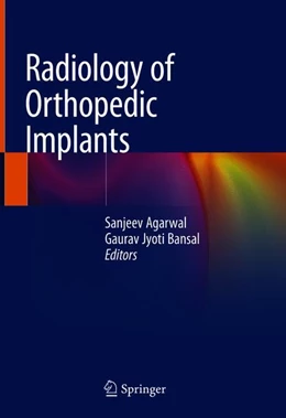 Abbildung von Agarwal / Bansal | Radiology of Orthopedic Implants | 1. Auflage | 2018 | beck-shop.de