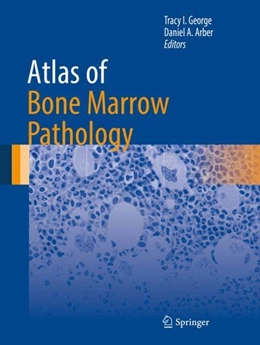 Abbildung von George / Arber | Atlas of Bone Marrow Pathology | 1. Auflage | 2018 | beck-shop.de