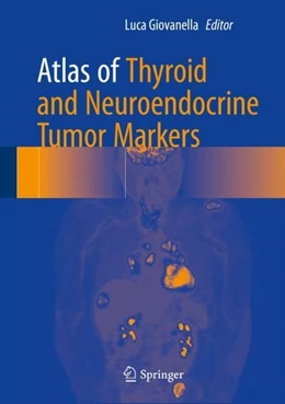 Abbildung von Giovanella | Atlas of Thyroid and Neuroendocrine Tumor Markers | 1. Auflage | 2018 | beck-shop.de