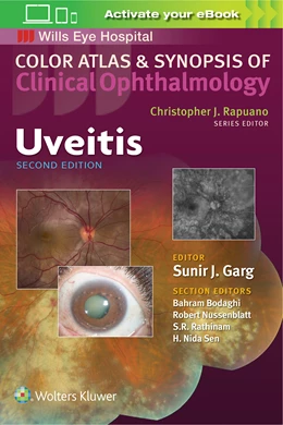 Abbildung von Garg | Uveitis (Color Atlas and Synopsis of Clinical Ophthalmology) | 2. Auflage | 2018 | beck-shop.de