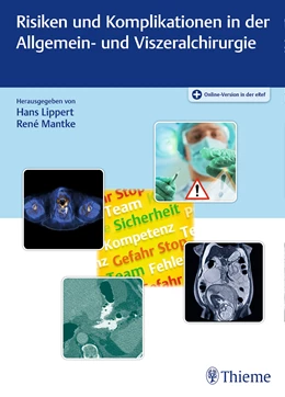 Abbildung von Lippert / Mantke | Risiken und Komplikationen in der Allgemein- und Viszeralchirurgie | 1. Auflage | 2022 | beck-shop.de
