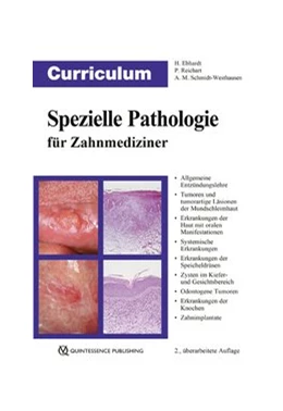 Abbildung von Ebhardt / Reichart | Curriculum Spezielle Pathologie für Zahnmediziner | 2. Auflage | 2018 | beck-shop.de