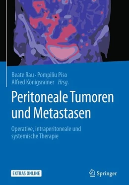 Abbildung von Rau / Piso | Peritoneale Tumoren und Metastasen | 1. Auflage | 2018 | beck-shop.de