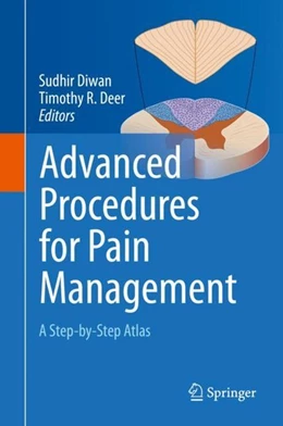 Abbildung von Diwan / Deer | Advanced Procedures for Pain Management | 1. Auflage | 2018 | beck-shop.de