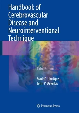Abbildung von Harrigan / Deveikis | Handbook of Cerebrovascular Disease and Neurointerventional Technique | 3. Auflage | 2018 | beck-shop.de
