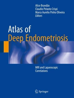 Abbildung von Brandão / Crispi | Atlas of Deep Endometriosis | 1. Auflage | 2018 | beck-shop.de