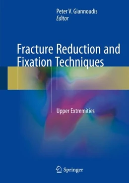 Abbildung von Giannoudis | Fracture Reduction and Fixation Techniques | 1. Auflage | 2018 | beck-shop.de