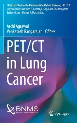 Abbildung von Agrawal / Rangarajan | PET/CT in Lung Cancer | 1. Auflage | 2018 | beck-shop.de